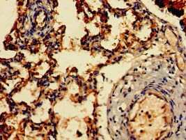 ARF1 Antibody
