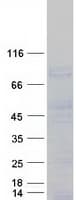 Human SMOC1 Protein (Recombinant Myc-DDK (Flag))
