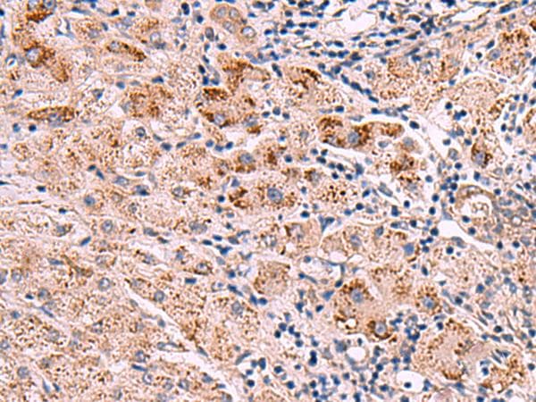 INPP5B Antibody