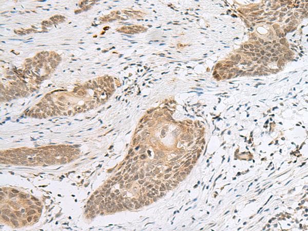 CALCOCO1 / CoCoa Antibody