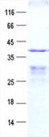 Human NAAA / ASAHL Protein (Recombinant His, N-Terminal)