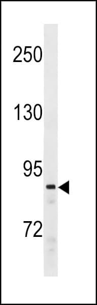 SUZ12 Antibody (aa559-588)