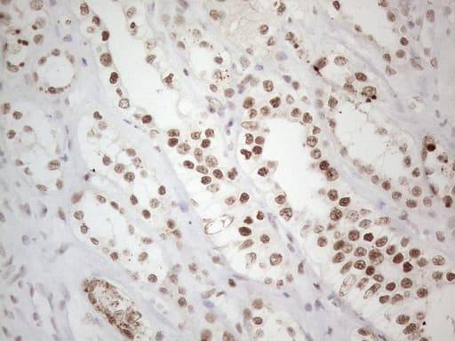 TP53BP1 / 53BP1 Antibody (aa1-300, clone OTI5E1)