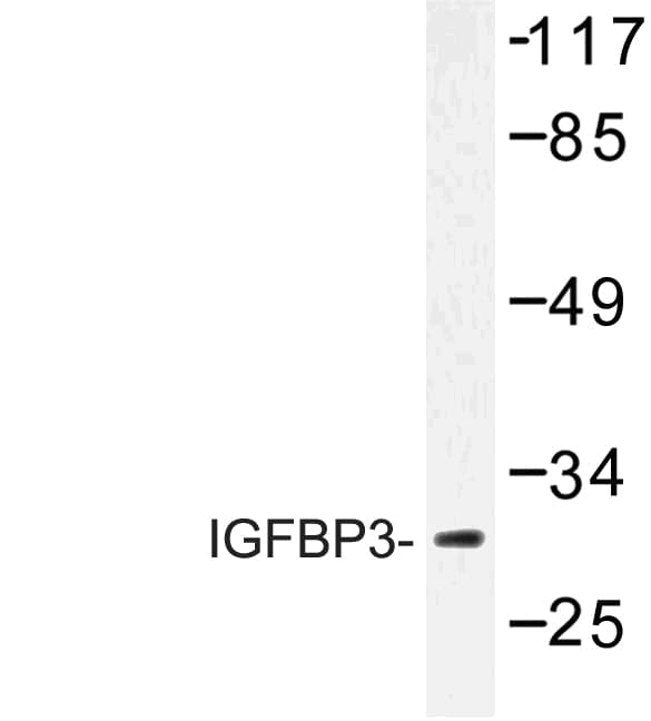 IGFBP3 Antibody (His179)
