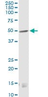 CNR1 / CB1 Antibody (clone 2F9)