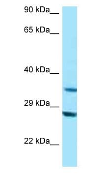 Polyclonal Rabbit anti-Human TOMM34 Antibody (N-Terminus, WB)