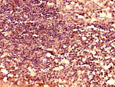 Polyclonal Rabbit anti-Human LY6H Antibody