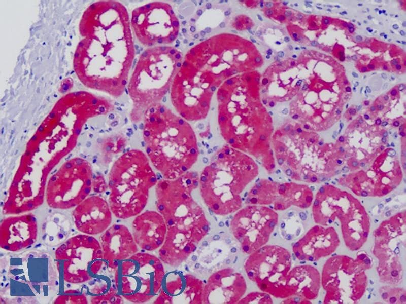IHC-plus™ GK / Glycerol Kinase Antibody (aa461-510)