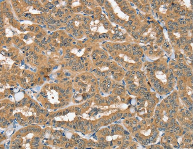 Polyclonal Rabbit anti-Human SEC14L2 Antibody (IHC, WB)