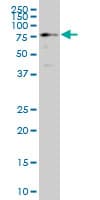 Monoclonal Mouse anti-Human HCLS1 Antibody (clone 1A8, IHC, WB)