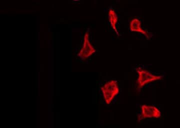WNK1 Antibody (phospho-Thr58)