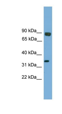 ESE3 / EHF Antibody (aa121-170)