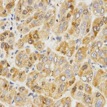 IHC-plus™ TPM2 Antibody