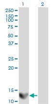 LGALS1 / Galectin 1 Antibody (clone 1E8-1B2)