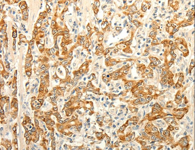 ERG Antibody