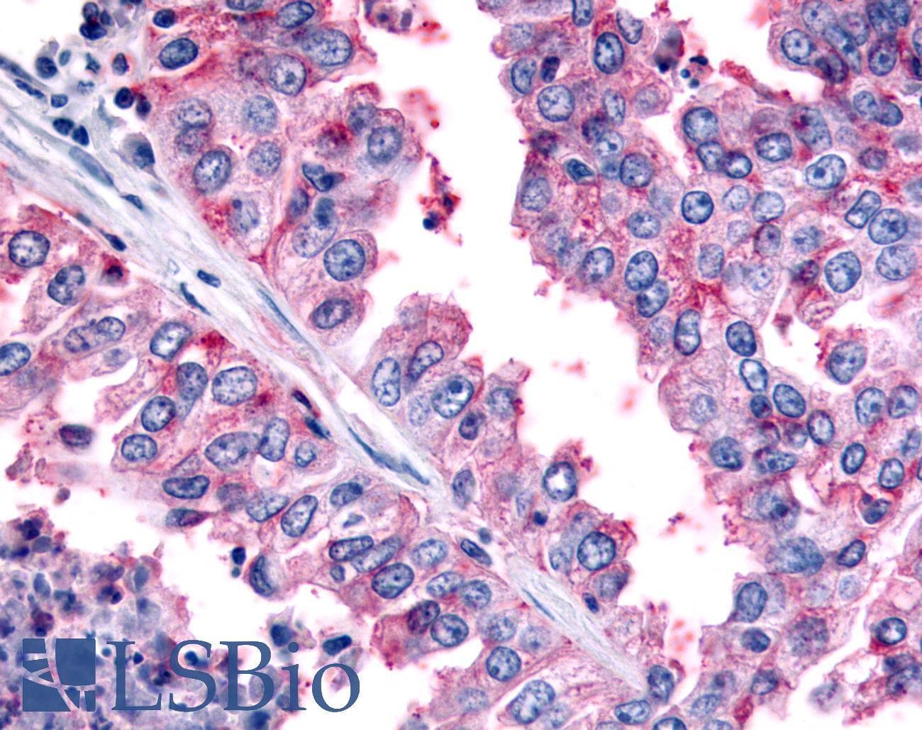 PathPlus™ Polyclonal Rabbit anti-Human PAK6 Antibody (Linker Domain, IHC)
