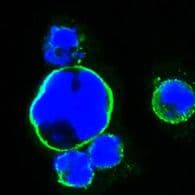 ISLET-1 / ISL1 Antibody (clone 1B1)