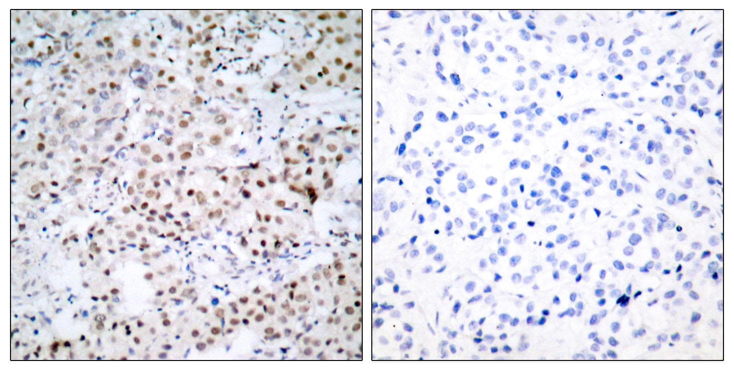 Polyclonal Rabbit anti-Human CREB1 / CREB Antibody (phospho-Ser133, IHC, WB)