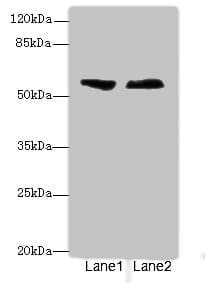 Polyclonal Rabbit anti-Human ENTPD2 Antibody (IHC, WB)