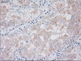 KRT19 / CK19 / Cytokeratin 19 Antibody (clone OTI4E12)