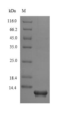 Human SNPH Protein (Recombinant 6His-SUMO, N-terminus)