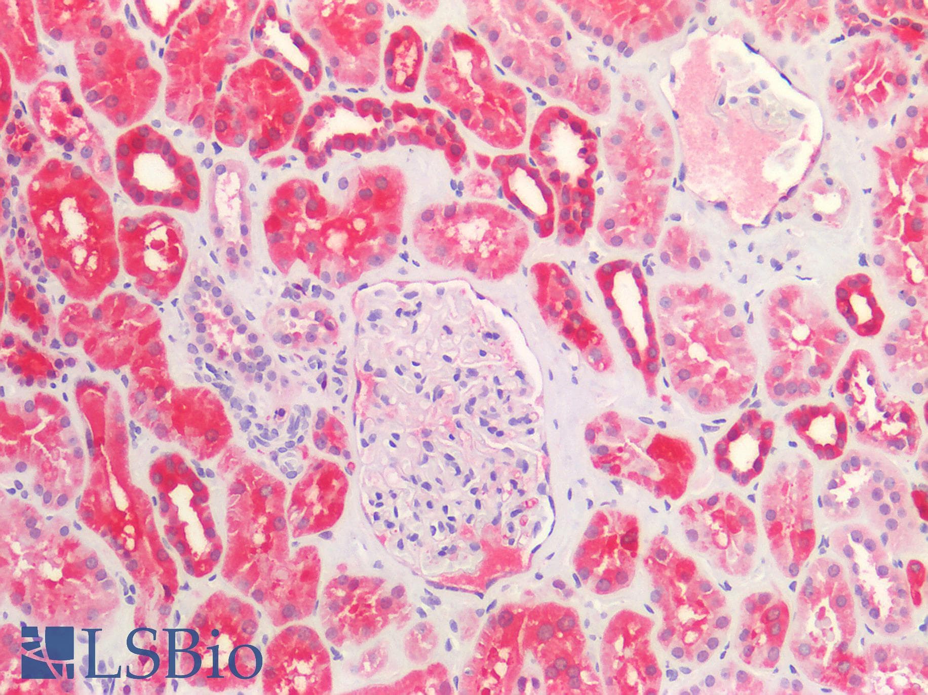 PathPlus™ ALDH1A1 / ALDH1 Antibody (clone 1G6)