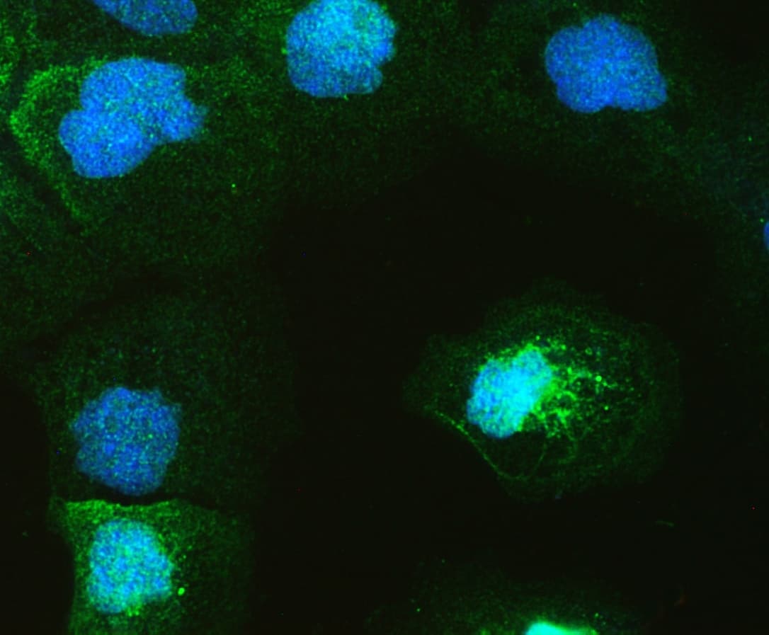 Polyclonal Rabbit anti-Human GAL4 / Galectin 4 Antibody (WB)
