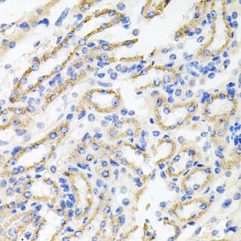 IRAK2 / IRAK-2 Antibody