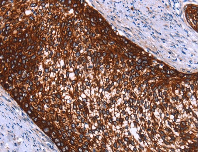 Polyclonal Rabbit anti-Human HMGCS2 / HMG-CoA Synthase 2 Antibody (IHC, WB)