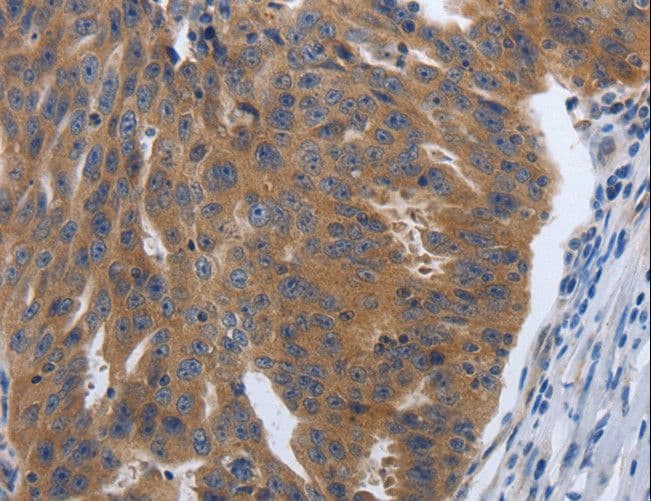 Polyclonal Rabbit anti-Human PDGF-AA Antibody (IHC)