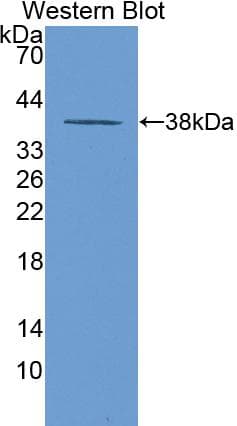 LDHB / Lactate Dehydrogenase B Antibody (aa1-334, Cy3)