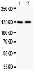 Polyclonal Rabbit anti-Human Hamartin / TSC1 Antibody (aa686-884, WB)