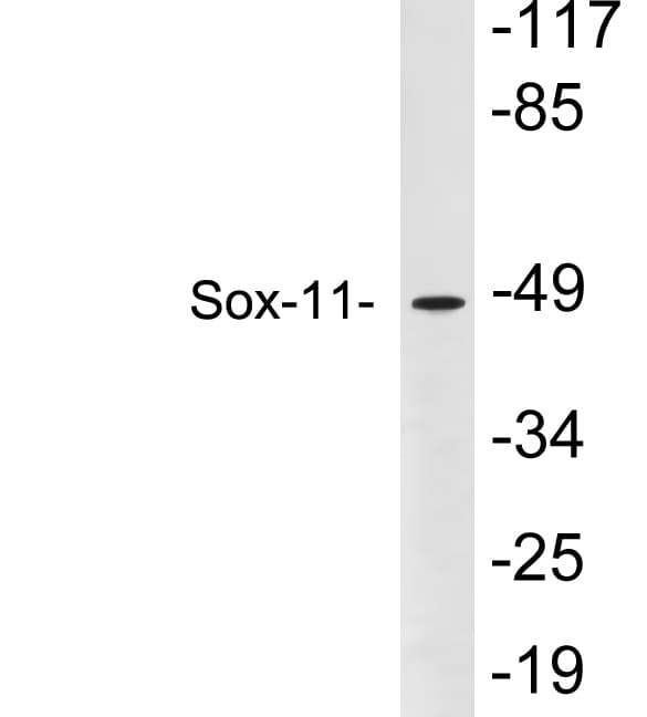 SOX11 Antibody (aa47-96)