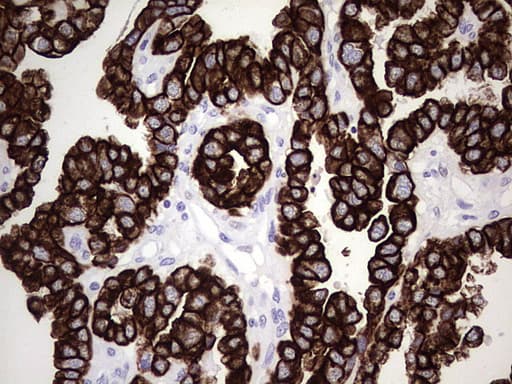 KRT7 / CK7 / Cytokeratin 7 Antibody (aa1-114, clone UMAB161)
