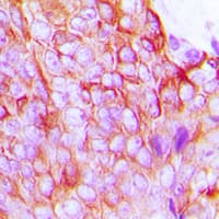 Polyclonal Rabbit anti-Human GJA1 / CX43 / Connexin 43 Antibody (C-Terminus, IHC, WB)