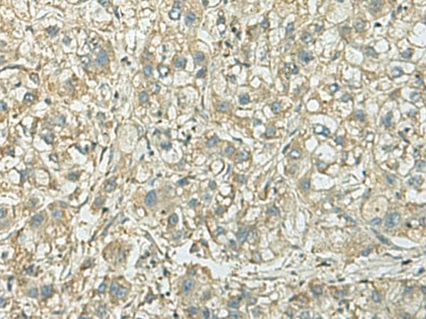 KIF21B Antibody