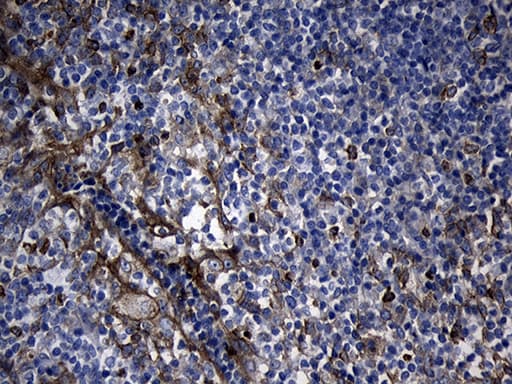 SLC9A1BP / CHP Antibody (clone OTI4B9)