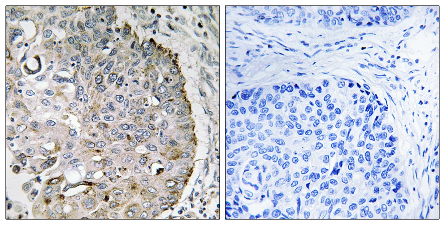 MRRF Antibody (aa181-230)