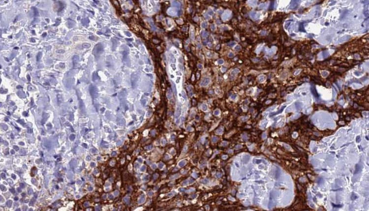 SLC4A3 / AE3 Antibody