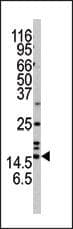 Polyclonal Rabbit anti-Human SNCA / Alpha-Synuclein Antibody (aa75-104, IHC, WB)