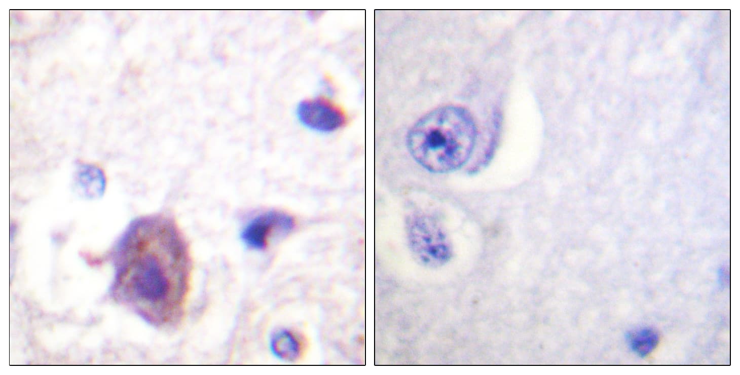 FAK / Focal Adhesion Kinase Antibody (phospho-Ser910)