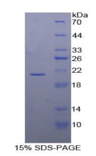 Horse IFN Gamma / Interferon Gamma Protein (Recombinant His-T7)