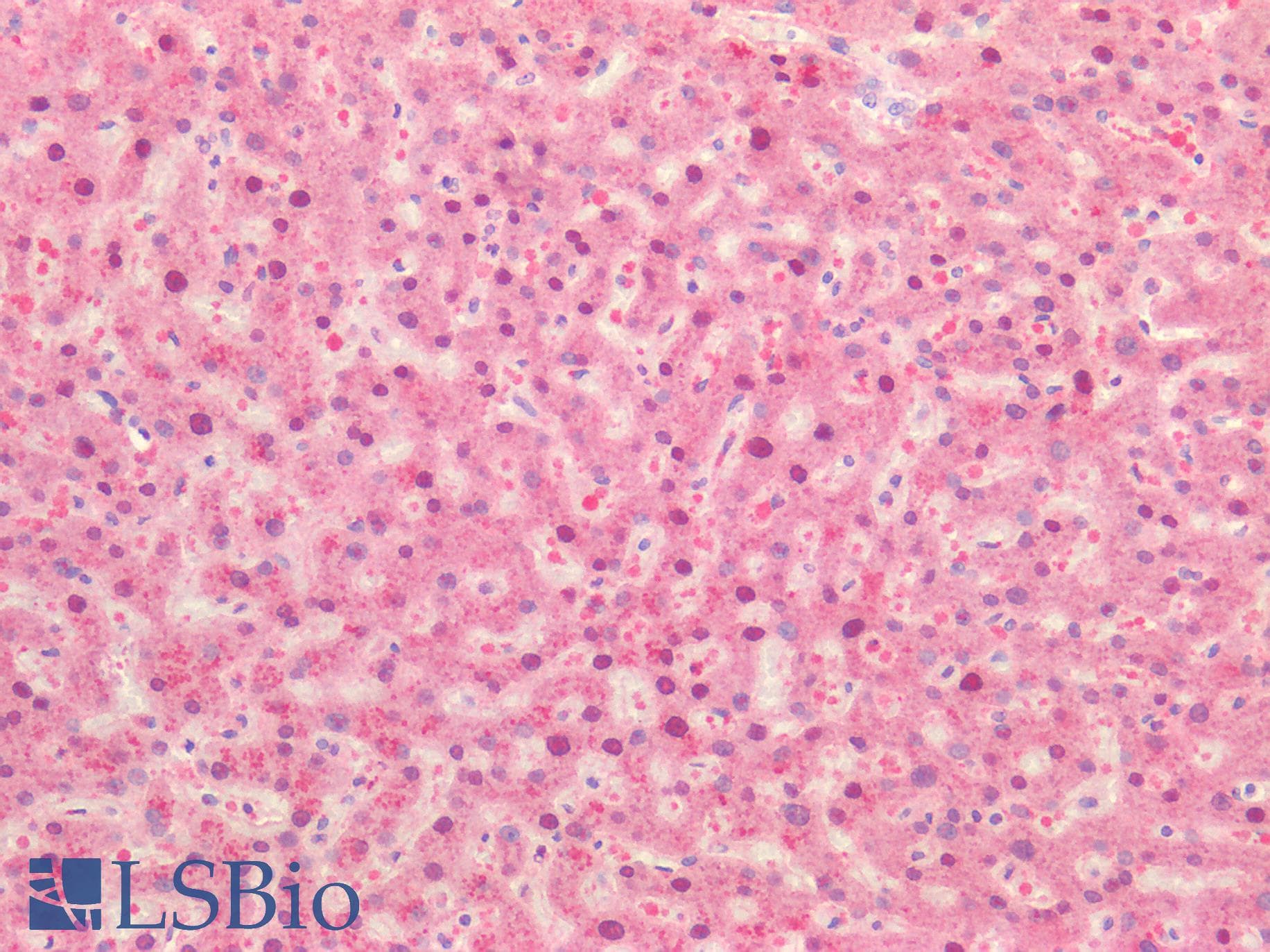 IHC-plus™ IL17A Antibody