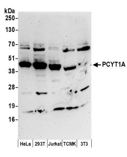 PCYT1A / CCT Alpha Antibody (aa317-367)