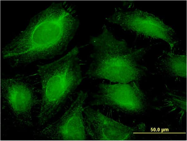 ABCF1 Antibody (clone 1B4)