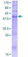 Human RHBDL3 Protein (Recombinant GST)