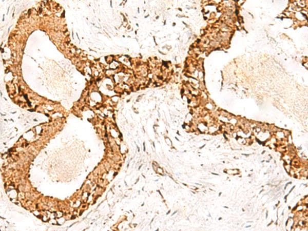 POLH / DNA Polymerase Eta Antibody