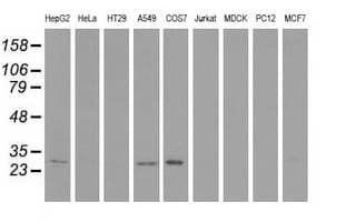Monoclonal Mouse anti-Human SPR Antibody (clone OTI2F7, WB)