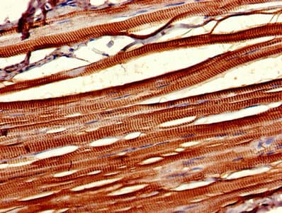 Polyclonal Rabbit anti-Human CSNK1D Antibody (IHC)