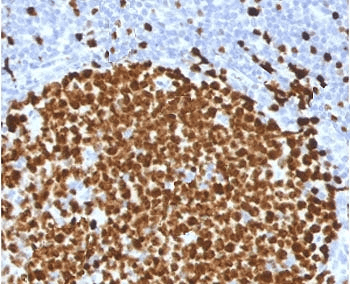 MKI67 / Ki67 Antibody (clone PMKI67-1)
